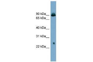 WB Suggested Anti-SLC6A5 Antibody Titration:  0. (SLC6A5 抗体  (Middle Region))