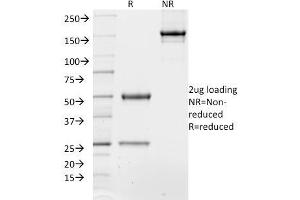 SDS-PAGE Analysis of Purified TCF4 Mouse Monoclonal Antibody (TCF4/1705). (TCF4 抗体  (AA 365-671))