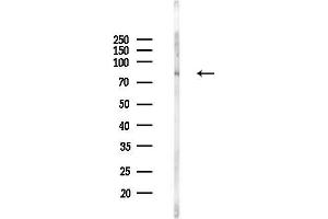 anti-Mitochondrial Intermediate Peptidase (MIPEP) (C-Term) antibody