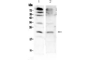 Western blot analysis of KGF using anti-KGF antibody . (FGF7 抗体  (AA 32-194))