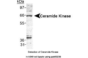 Image no. 1 for anti-Ceramide Kinase (CERK) (AA 50-150) antibody (ABIN363547) (CERK 抗体  (AA 50-150))