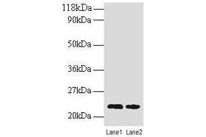 Western blot All lanes: TAGLN antibody at 2 μg/mL Lane 1: EC109 whole cell lysate Lane 2: 293T whole cell lysate Secondary Goat polyclonal to rabbit IgG at 1/15000 dilution Predicted band size: 23 kDa Observed band size: 23 kDa (Transgelin 抗体  (AA 2-201))