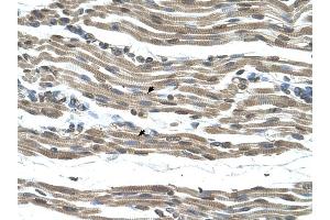 COX15 antibody was used for immunohistochemistry at a concentration of 4-8 ug/ml to stain Skeletal muscle cells (arrows) in Human Muscle. (COX15 抗体)