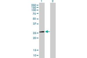 Western Blotting (WB) image for anti-Myosin, Light Chain 6B, Alkali, Smooth Muscle and Non-Muscle (MYL6B) (AA 1-208) antibody (ABIN530784)