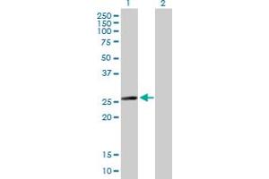 Western Blot analysis of MYL6B expression in transfected 293T cell line by MYL6B MaxPab polyclonal antibody. (MYL6B 抗体  (AA 1-208))