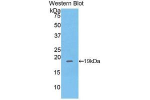 Western blot analysis of the recombinant protein. (PHLDA2 抗体  (AA 9-140))