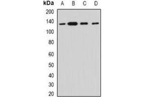 Western blot analysis of Myosin Ic expression in HT29 (A), SKOV3 (B), mouse lung (C), rat heart (D) whole cell lysates. (Myosin IC 抗体)