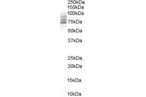 Western Blotting (WB) image for anti-Cytochrome B-561 (CYB561) (N-Term) antibody (ABIN2777099) (CYB561 抗体  (N-Term))