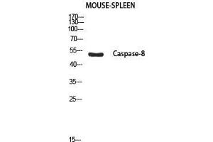Western Blot (WB) analysis of Mouse Spleen using Cleaved-Caspase-8 p18 (S217) antibody. (Caspase-8 p18 抗体  (cleaved, Ser217))