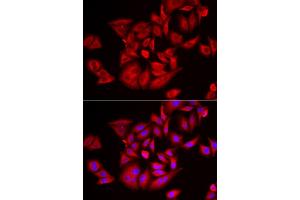 Immunofluorescence analysis of U2OS cells using TLK2 antibody. (TLK2 抗体)