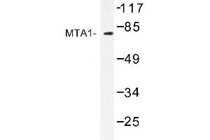 Image no. 1 for anti-Metastasis Associated 1 (MTA1) antibody (ABIN272222) (MTA1 抗体)