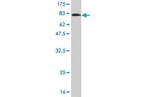 Western Blotting (WB) image for anti-5'-Nucleotidase, Cytosolic II (NT5C2) (AA 1-561) antibody (ABIN524900)