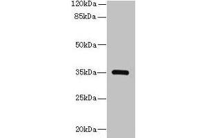 Western blot All lanes: STX19 antibody at 2 μg/mL + K562 whole cell lysate Secondary Goat polyclonal to rabbit IgG at 1/10000 dilution Predicted band size: 35 kDa Observed band size: 35 kDa (Syntaxin 19 抗体  (AA 1-140))
