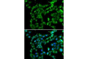 Immunofluorescence analysis of U20S cell using PRKAB2 antibody. (PRKAB2 抗体)