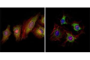 Immunofluorescence analysis of Hela (left) and HepG2 (right) cells using EphB2 mouse mAb (green). (EPH Receptor B2 抗体  (AA 17-200))