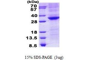 Image no. 1 for POU Class 5 Homeobox 1 (POU5F1) protein (His tag) (ABIN1098764) (OCT4 Protein (His tag))