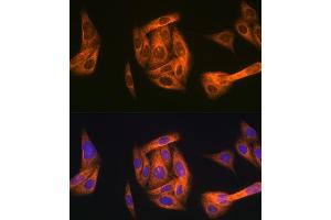 Immunofluorescence analysis of U-2 OS cells using T Rabbit mAb (ABIN1680832, ABIN7101518, ABIN7101519 and ABIN7101520) at dilution of 1:100 (40x lens). (TAB1 抗体)