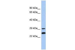 NSMCE2 antibody used at 1 ug/ml to detect target protein. (NSMCE2 抗体)