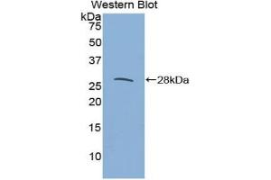 Western blot analysis of the recombinant protein. (IL27 Receptor alpha 抗体  (AA 123-343))