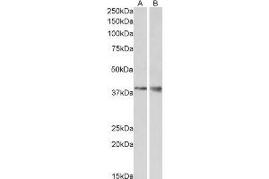 WNT9B 抗体  (Internal Region)