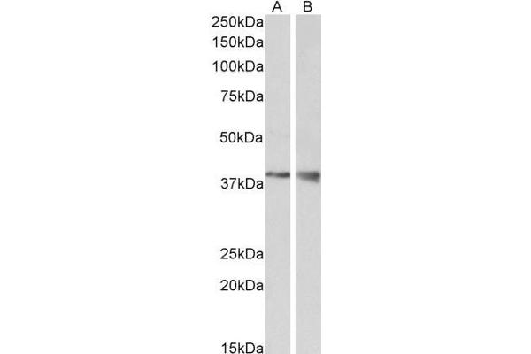 WNT9B 抗体  (Internal Region)