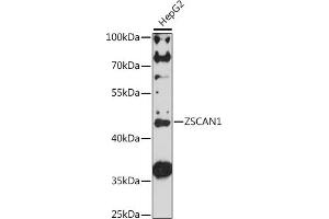 Western blot analysis of extracts of HepG2 cells, using ZSC antibody (ABIN7271441) at 1:1000 dilution. (ZSCAN1 抗体  (AA 300-400))