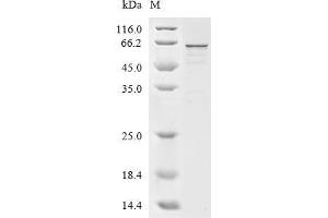 (Tris-Glycine gel) Discontinuous SDS-PAGE (reduced) with 5 % enrichment gel and 15 % separation gel.