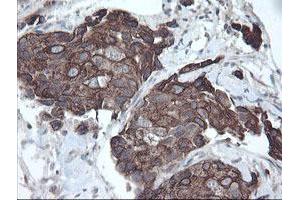 Image no. 2 for anti-Diphthamide Biosynthesis Protein 2 (DPH2) antibody (ABIN1497892) (DPH2 抗体)