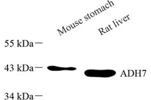 Western blot analysis of ADH7 (ABIN7072995) at dilution of 1: 500 (ADH7 抗体)