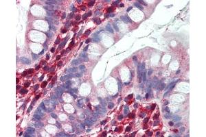 LDHB antibody was used for immunohistochemistry at a concentration of 4-8 ug/ml. (LDHB 抗体  (C-Term))
