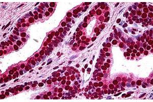 Human Prostate: Formalin-Fixed, Paraffin-Embedded (FFPE) (MEF2A 抗体  (AA 71-170))