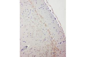 Anti-GABA A Receptor alpha 1 antibody, IHC(P) IHC(P): Rat Brain Tissue