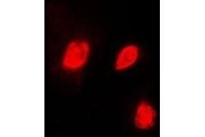 Immunofluorescent analysis of EID1 staining in HeLa cells. (EID1 抗体)