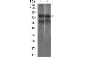 Western Blotting (WB) image for anti-Guanylate Cyclase 1 Soluble Subunit Alpha (GUCY1A1) (AA 22-214) antibody (ABIN1724787)