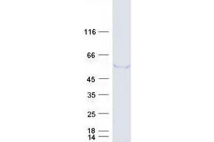 Western Blotting (WB) image for Tripartite Motif Containing 39 (TRIM39) (Transcript Variant 2) protein (Myc-DYKDDDDK Tag) (ABIN2712387)