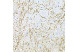 Immunohistochemistry of paraffin-embedded mouse spinal cord using CNP antibody. (Cnpase 抗体  (AA 152-421))