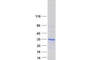 SHOX Protein (Transcript Variant 1) (Myc-DYKDDDDK Tag)