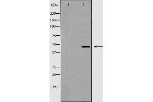 Western blot analysis of CRFR2 expression in K562 cells. (CRHR2 抗体  (Internal Region))