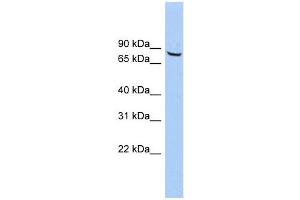 ACCN4 antibody used at 1 ug/ml to detect target protein. (ACCN4 抗体  (Middle Region))