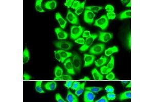 Immunofluorescence analysis of MCF-7 cells using RPS3A Polyclonal Antibody (RPS3A 抗体)