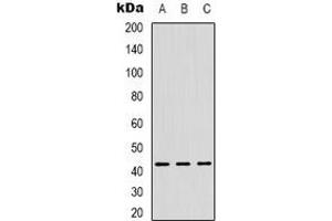 Western blot analysis of ZNF24 expression in Hela (A), Jurkat (B), HUVEC (C) whole cell lysates. (ZNF24 抗体  (N-Term))