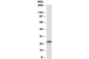 Western blot testing of human testis lysate with RAN antibody at 1ug/ml. (RAN 抗体)