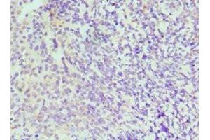 Immunohistochemistry of paraffin-embedded human tonsil tissue using ABIN7156622 at dilution of 1:100 (IRF4 抗体  (AA 180-451))