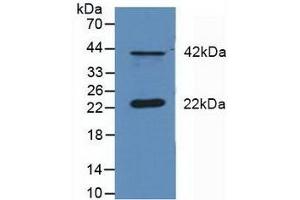 Detection of DUSP6 in Mouse Cerebellum Tissue using Polyclonal Antibody to Dual Specificity Phosphatase 6 (DUSP6) (DUSP6 抗体  (AA 1-300))