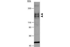 Western blot analysis of Flt1 in chimeric CSF-1R/VEGFR-2 detection in transfected lysates using Flt1 polyclonal antibody . (FLT1 抗体  (AA 800-900))