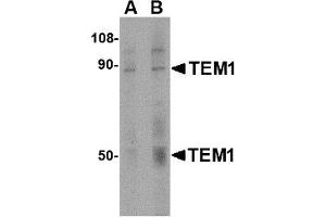 Western Blotting (WB) image for anti-CD248 Molecule, Endosialin (CD248) (C-Term) antibody (ABIN1030727) (CD248 抗体  (C-Term))