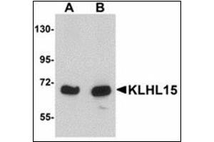 Western blot analysis of KLHL15 in HeLa cell lysate with KLHL15 antibody at (A) 1 and (B) 2 µg/ml. (KLHL15 抗体  (C-Term))