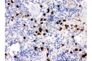 Anti- S100A9 Picoband antibody, IHC(P) IHC(P): Rat Spleen Tissue (S100A9 抗体  (AA 2-113))