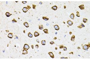 Immunohistochemistry (Paraffin-embedded Sections) (IHC (p)) image for anti-Interferon Regulatory Factor 1 (IRF1) antibody (ABIN7263697)