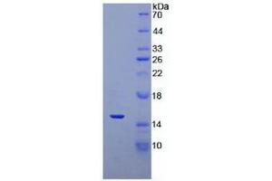 SDS-PAGE analysis of recombinant Human DEFa5. (DEFA5 蛋白)